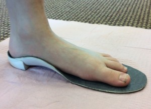 Flat Foot with Orthotic