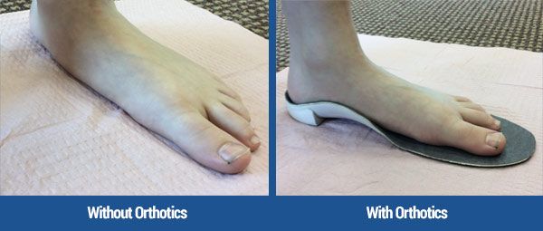With and without custom foot orthotics.