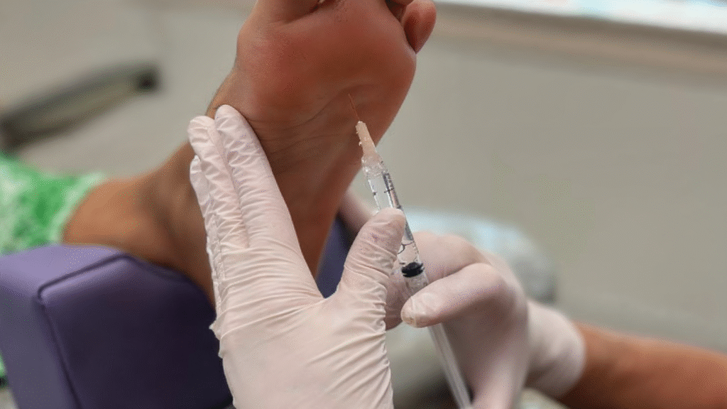 Fat Pad Restoration being performed on a patient’s foot at Alpine Foot Specialists in Lake Zurich IL